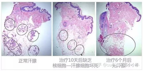 明星狐臭 腋下出汗更尴尬,神器来了 秒杀腋窝那些不可告人的事