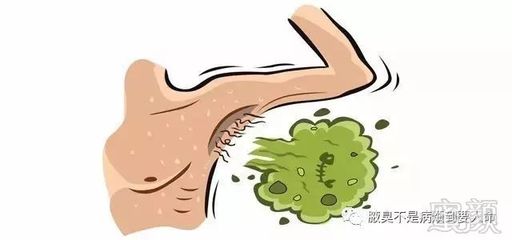 专家科普 | 腋臭会不会传染?