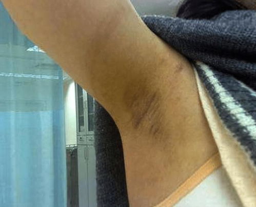 有狐臭的人,自己却很难闻到 到底有没有办法去掉 坏了的葱味