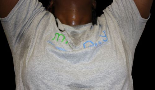 miradry清新微波 给自己一个小时去除狐臭 用清新迎接2020