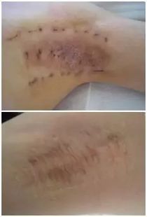 体臭与腋臭的真相解密 必看狐臭成因与解决指南