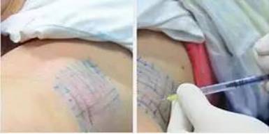 最后1天！保妥适全国大涨价，最低价仅限明天，手慢无！