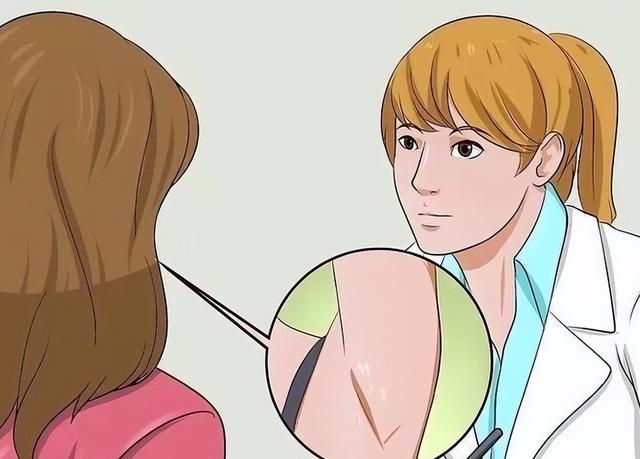 狐臭（腋臭）的病因解析与综合治疗方案